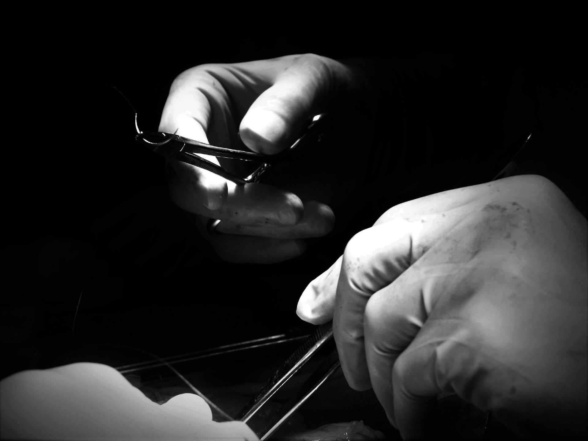 Close-up of a surgeon's hands performing a procedure with surgical tools, illustrating precision and care during a medical operation.